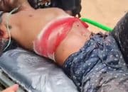 Kerusuhan Sorong, Diduga Satu Orang Terkena Tembakan Aparat Keamanan