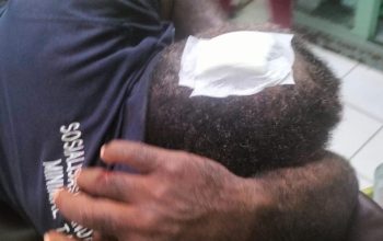 Sempat Viral di Medsos, Korban Lakalantas di Jalan Cenderawasih Timika Hanya Alami Luka Ringan