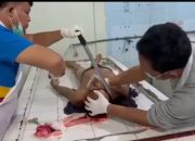 Sadis! Seorang Pria Ditemukan Tewas di Holtekamp Dengan Kapak Masih Menancap di Kepala, Polisi: Itu Hoaks