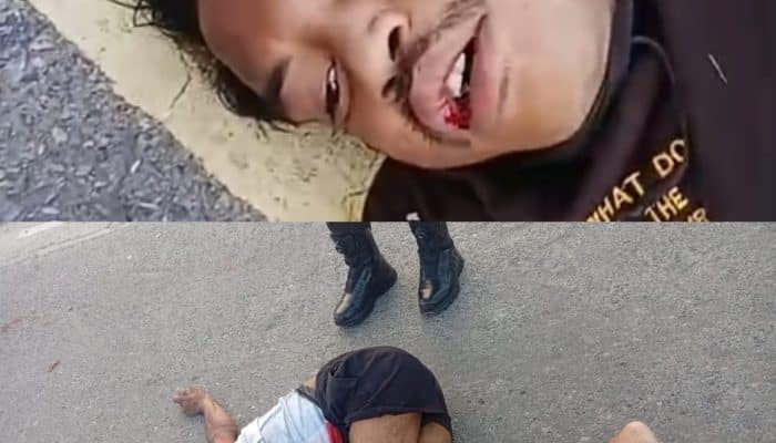 Lakalantas di Jalan Yos Sudarso Timika, Dua Orang Tergeletak, Satu Orang Patah Kaki