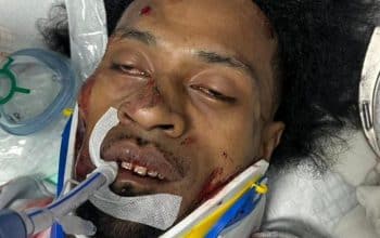 Kondisi Satu Korban Lakalantas di Jalan Yos Sudarso Timika Terus Memburuk, Belum Ada Keluarga yang Datang